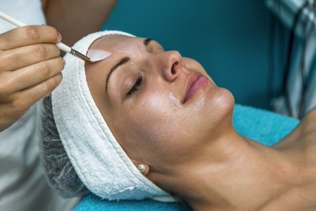 chemical peels fort lauderdale