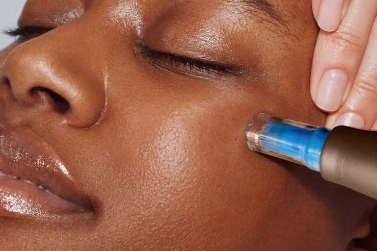 microneedling oakland park fl